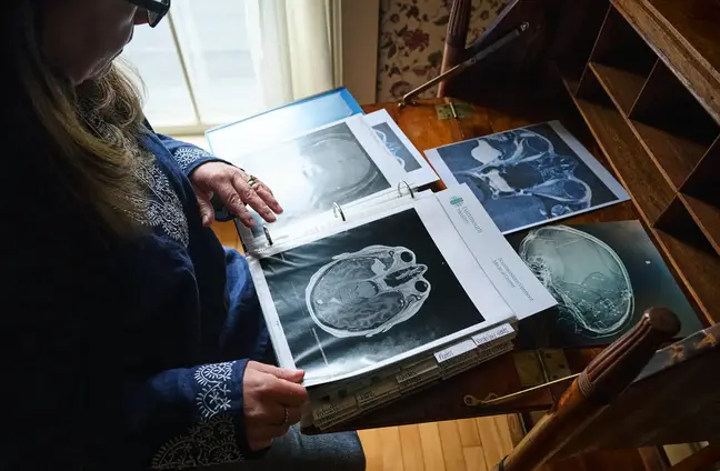 A woman seated at a table looks at a notebook with images of brainscans
